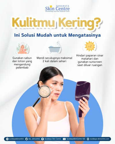PostPhoto