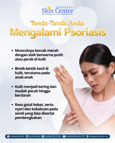PostPhoto