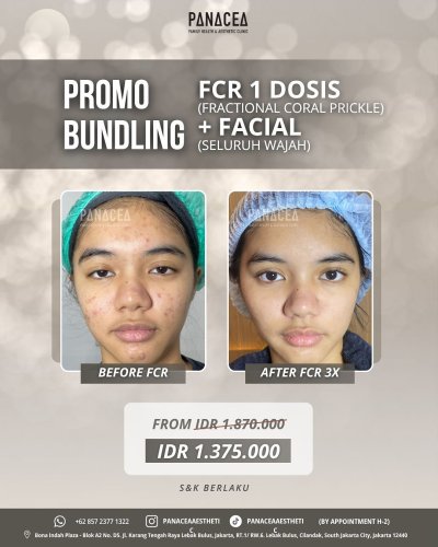 PostPhoto