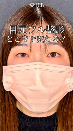 Video post from tcb_kabuto.