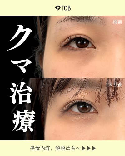Carousel post from tcb_tomita_ryo.