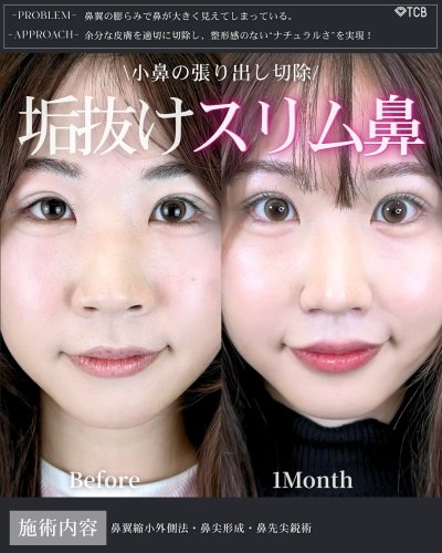 Carousel post from tcb_maruta__hana.