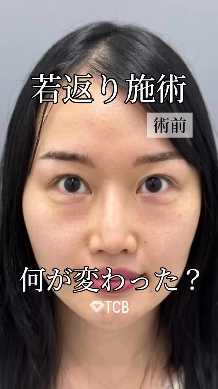 Video post from tcb_sano.