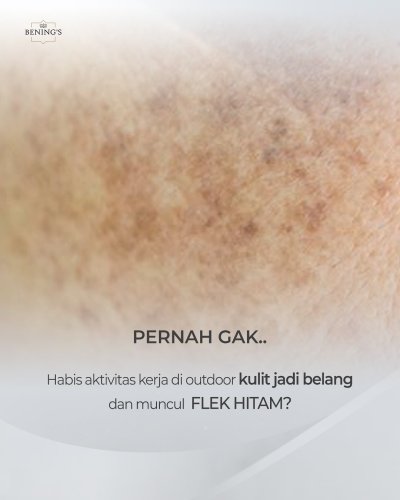 PostPhoto