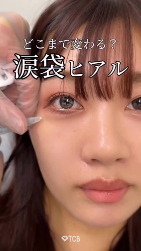 Video post from tcb_banno.