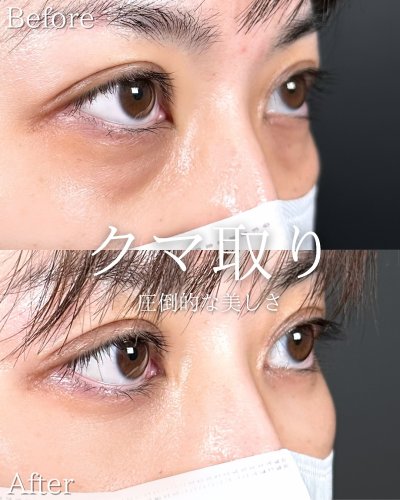Carousel post from tcb_iwamoto.