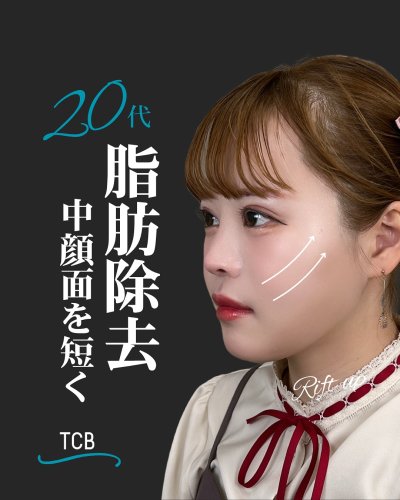 Carousel post from tcb_yamamoto.