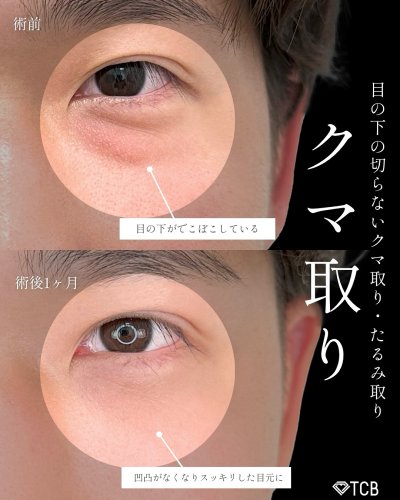 Carousel post from tcb_hashimoto.
