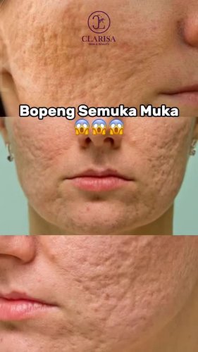 PostPhoto
