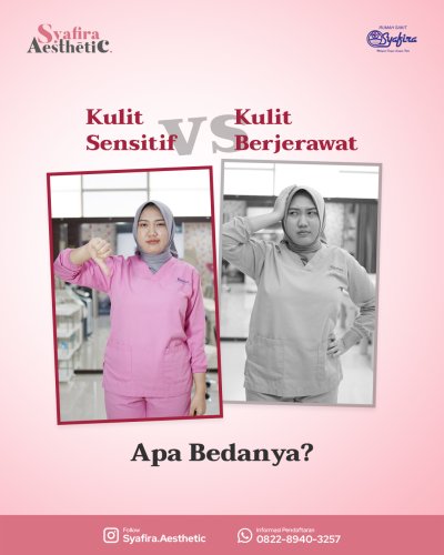 PostPhoto