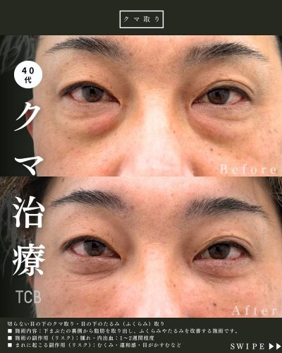 Carousel post from tcb_yamada.