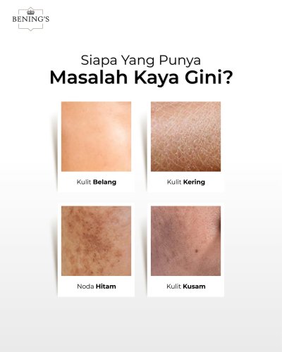 PostPhoto