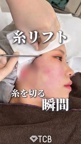 Video post from tcb_omi.