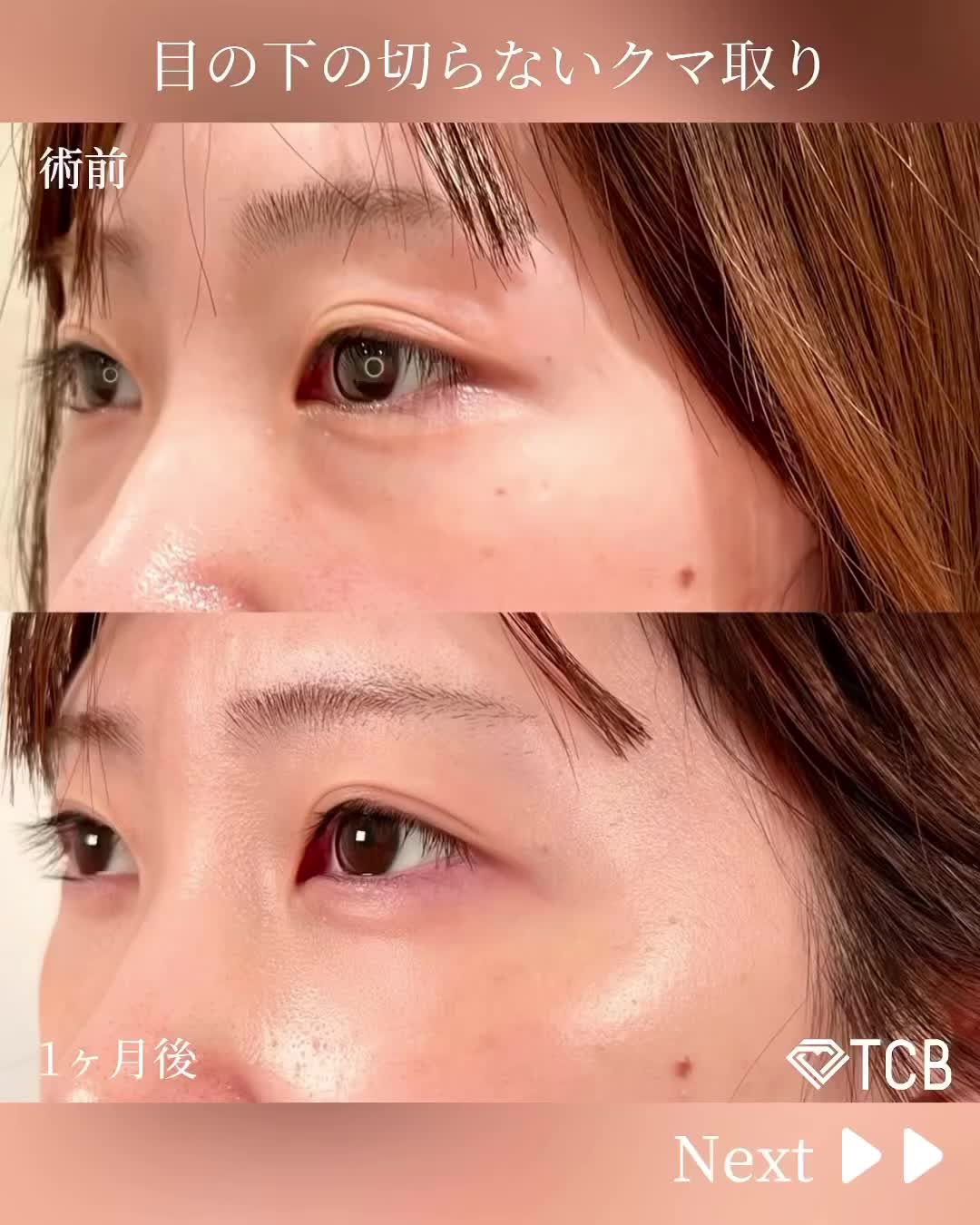 Carousel post from tcb_sano_eiki_.