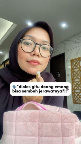 PostPhoto