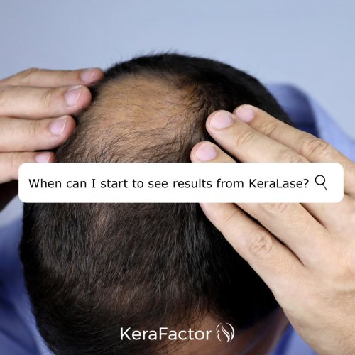 Photo post from kerafactor.