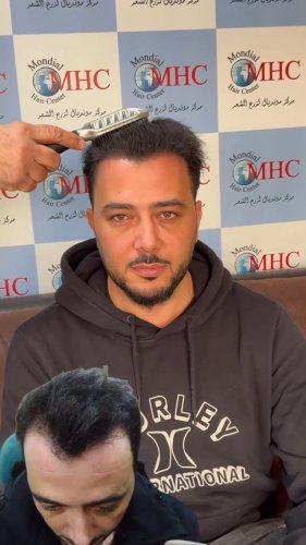 Video post from mondialhaircenter.