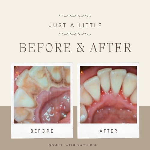 Photo post from trilliumdental.