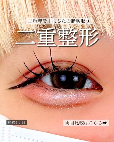 Carousel post from tcb.nakagawa.yumiko.