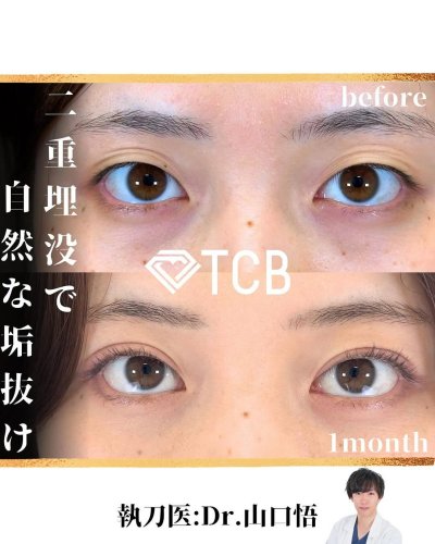 Carousel post from tcb_yamaguchi.s.