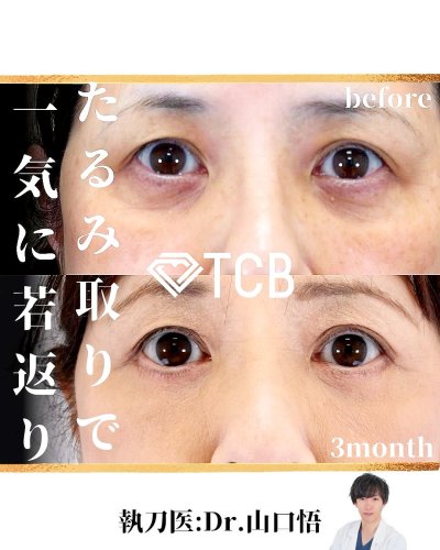 Carousel post from tcb_yamaguchi.s.