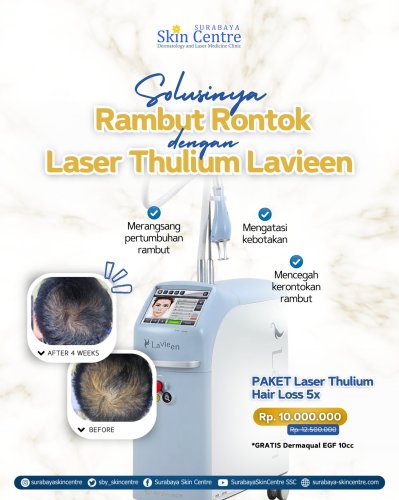 PostPhoto
