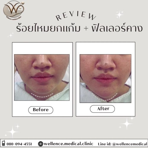 PostPhoto