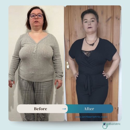 Photo post from antbariatric.