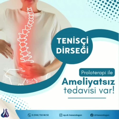 Video post from op.dr.hasandogan.