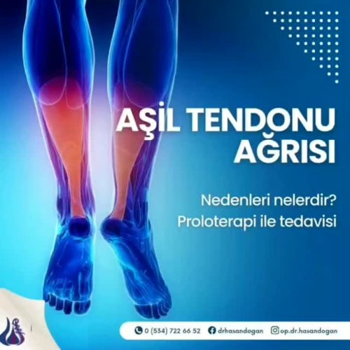 Video post from op.dr.hasandogan.