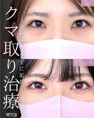 Carousel post from tcb_kuribayashi.