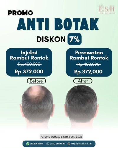 PostPhoto