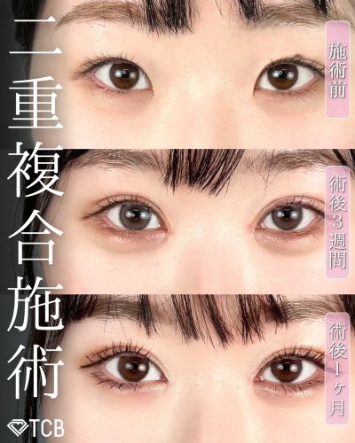 Carousel post from tcb_kuribayashi.