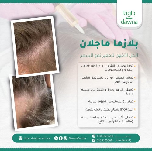 Photo post from dawnacenter.
