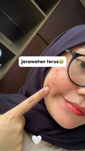 PostPhoto