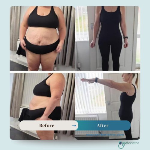 Photo post from antbariatric.