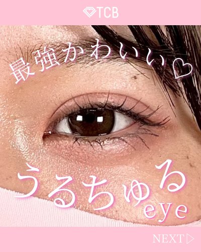 北村 可恋 | 美容整形はTCB東京中央美容外科