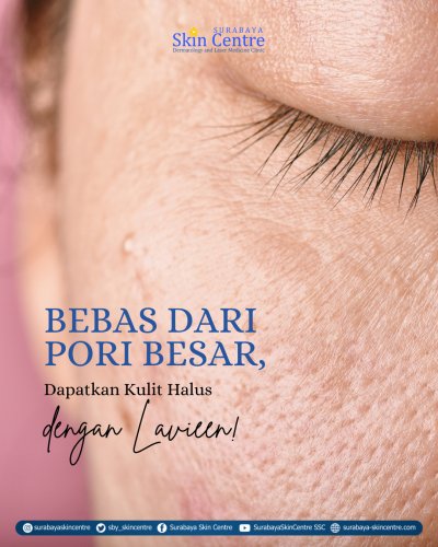 PostPhoto
