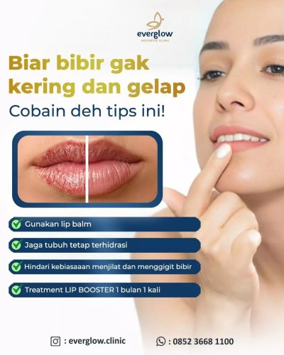 PostPhoto