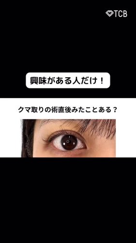 Video post from tcb_kushitan.