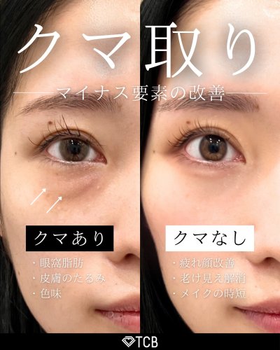 Carousel post from tcb_watanabe.shiori.