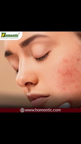 Video post from homeotic_international.