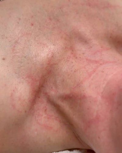 Video post.