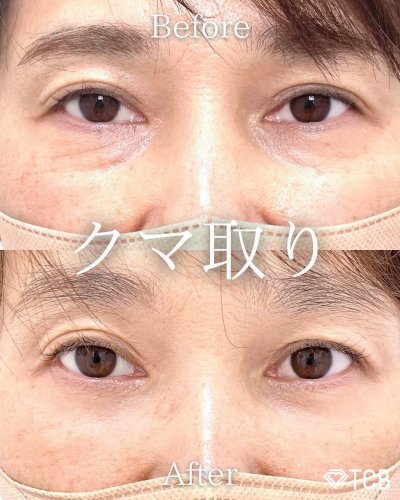Carousel post from tcb_yuasa_kento.