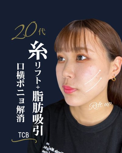 Carousel post from tcb_kawashima.y.