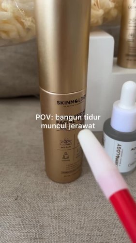 PostPhoto