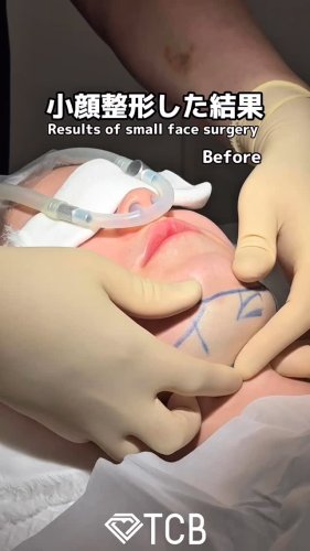 Video post from tcb_omi.