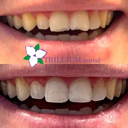 Photo post from trilliumdental.