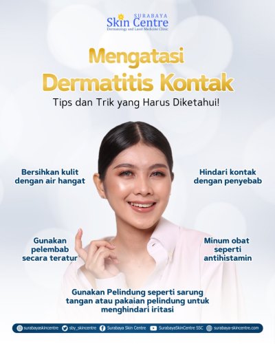 PostPhoto