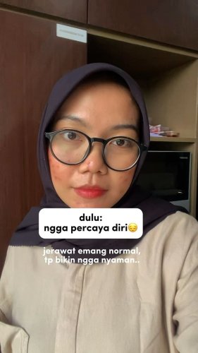 PostPhoto